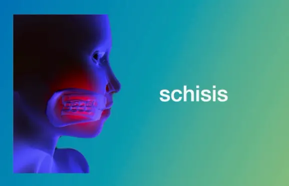 schisis in behandeling